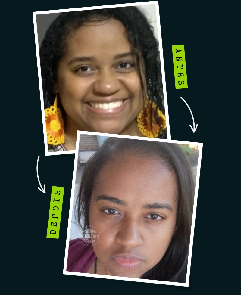 antes-depois-site (2)